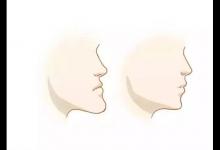 地包天面相好嗎 男女地包天面相