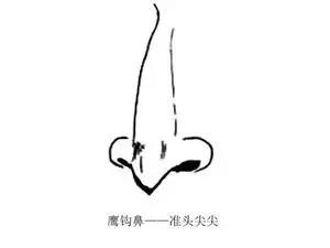 女人鷹鼻子的面相如何,是否會影響命運(yùn)(圖文)