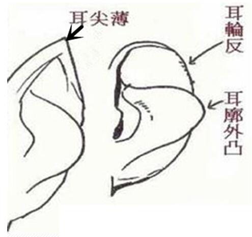 女人大耳垂的面相好嗎,怎么的耳朵算得上好耳相(圖文)