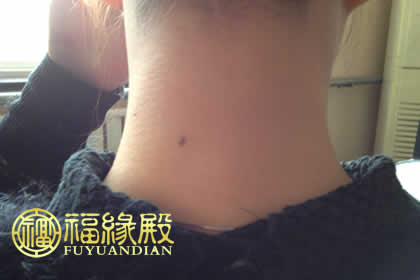 苦情痣怎么尋前世戀人(圖文)