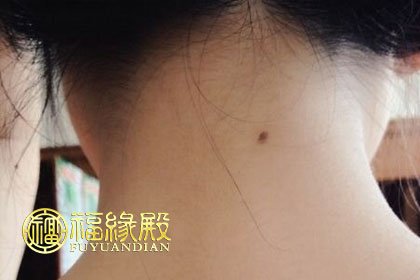 苦情痣圖片 苦情痣長在哪里圖解(圖文)