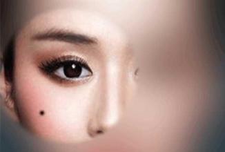 嘴周?chē)虚L(zhǎng)痣的感情運(yùn)勢(shì)如何？顴骨上的痣的含義是什么？(圖文)
