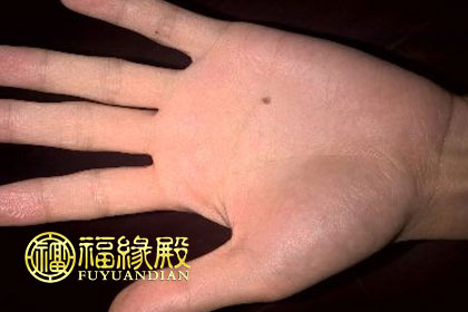 掌心有痣代表什么 有哪些說法(圖文)
