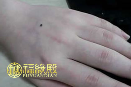 手背上有痣的女人好不好(圖文)