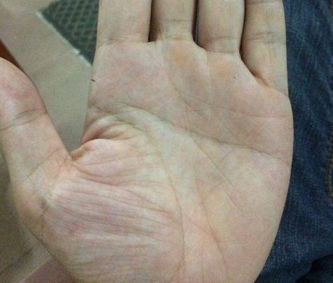 假斷掌圖片