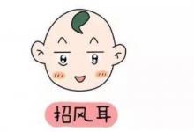 招風耳的人面相命運如何