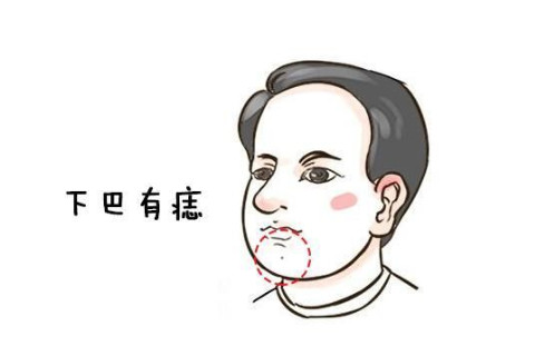 面相圖解：下巴有痣代表什么?運氣好嗎？