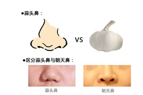   如何從鼻型和鼻子面相看出這個人是不是性格好？這里給你揭秘