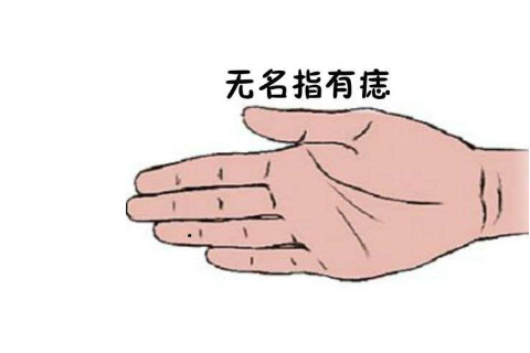 一個人的左手無名指長痣是有什么含義嗎？