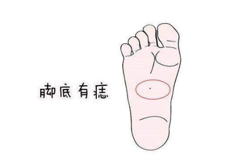 面相分析：男人女人腳底有一顆痣是有什么說法