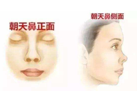 男人女人有著朝天鼻面相一生中是沒有福氣的