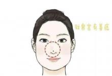 女人鼻尖有痣面相怎么樣，命運(yùn)怎么樣？