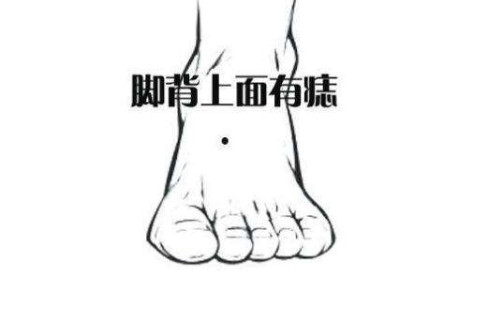 腳背上面有痣的人命運好不好