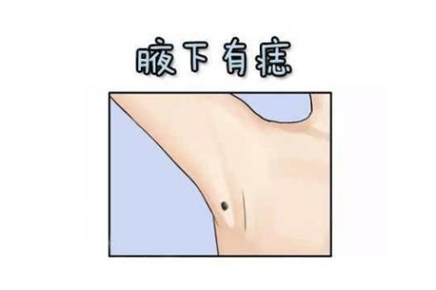 身上痣的位置和命運的關系（一）