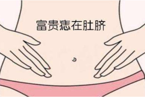 肚臍有痣的人運勢如何