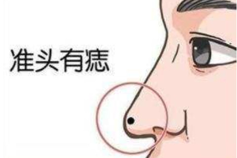 男人左邊有痣面相解析