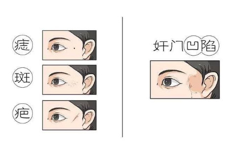 奸門塌陷的人好不好