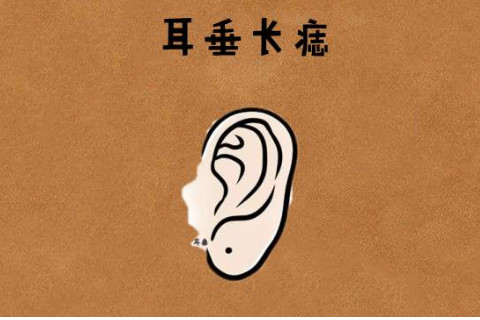 耳朵有痣面相特征分析