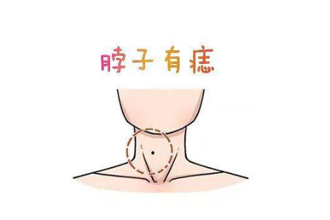 哪些是好痣（二）