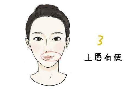 嘴巴長(zhǎng)痣圖解大全