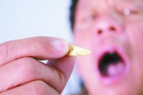 夢見牙齒掉了一顆