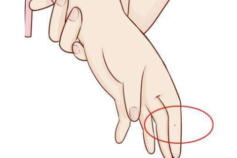 手中長(zhǎng)痣的人運(yùn)勢(shì)如何