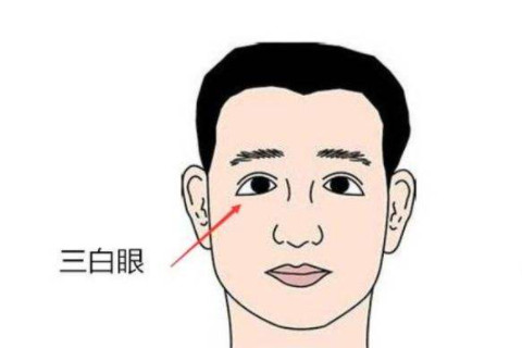 三白眼的人面相分析