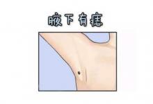 女人旺子女的痣相分析