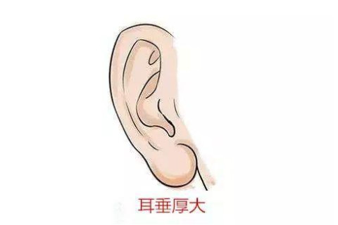 佛耳是什么樣的耳朵？