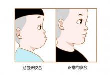 兜齒是什么？兜齒的人運勢分析