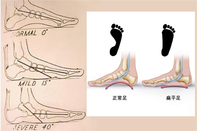 八字相同命不同案例_八字相同劉翔_八字相同命運不同