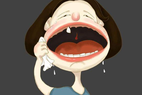 做夢夢見牙掉了