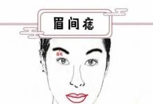 注定一生享福的痣相