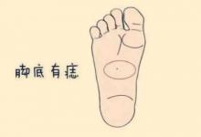 男人的福痣有哪些？