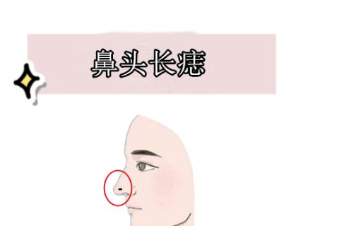 如何通過痣相看健康？