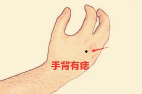 手臂有痣的女人幫夫運強嗎？