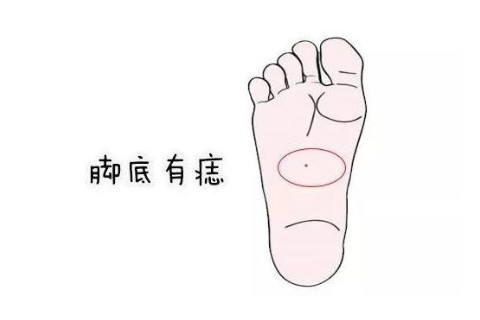 右腳底有痣代表了什么？