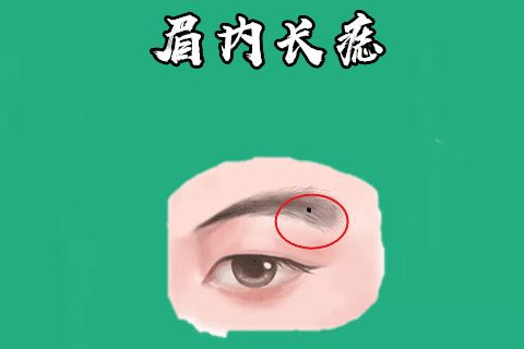 旺財痣有哪些？
