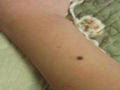 額頭上有哪些痣？額頭痣相的命運解析