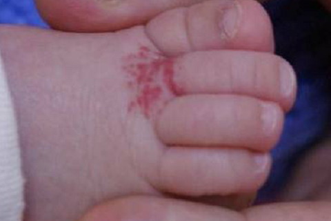 腳趾有痣的女人代表什么?腳趾有痣的女人命運(yùn)