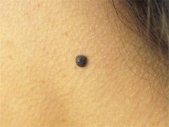 雙眼皮的面相分析,雙眼皮的人有什么特征