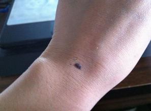 男人人中有痣的含義,男的人中有痣好嗎