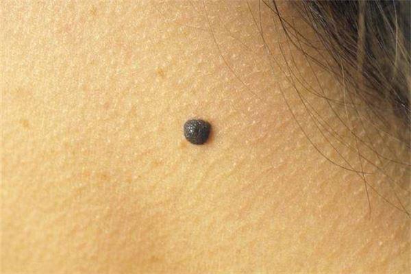 怎樣從下巴外形看命運如何,從下巴看人 怎樣從下巴外形看命運如何,從下巴看人